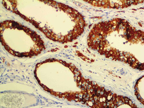 IHC of Inhibin Alpha on an FFPE Testicle Tissue